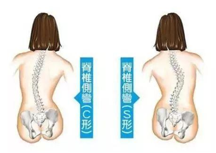 放射科DR長骨拼接成像新技術(shù)簡介