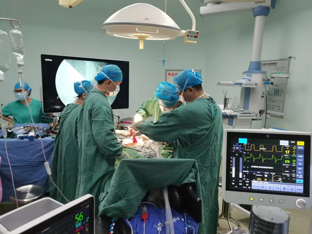 【技術(shù)聚焦】省醫(yī)院托管助力，建立緊密型科室專科聯(lián)盟，我院成功完成高難度腹腔鏡結(jié)直腸癌根治術(shù)